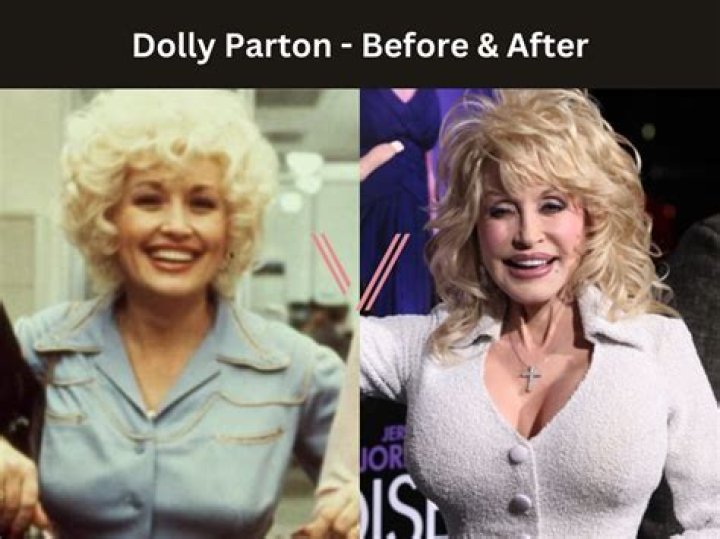 Are Dolly Parton's Boobs Real? Uncovering The Truth Behind The Iconic Figure