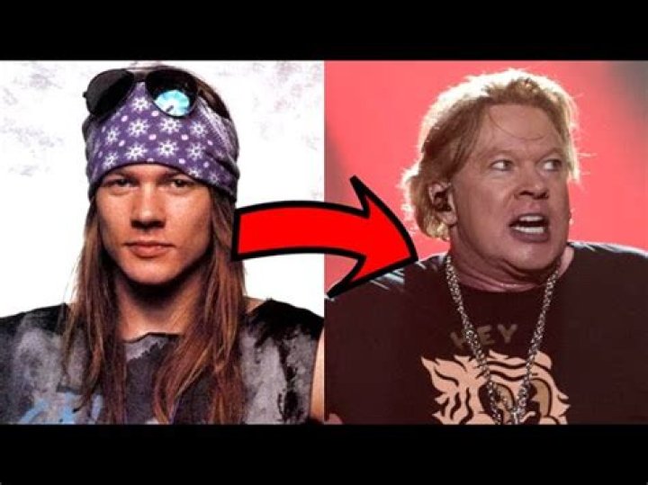 Axl Rose Transformation: A Journey Through Time
