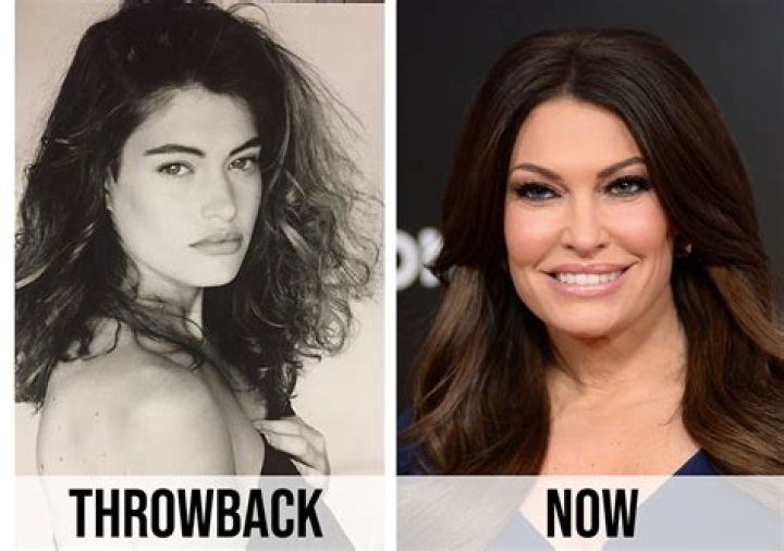 Behind The Changes: What Happened To Kimberly Guilfoyle's Face?