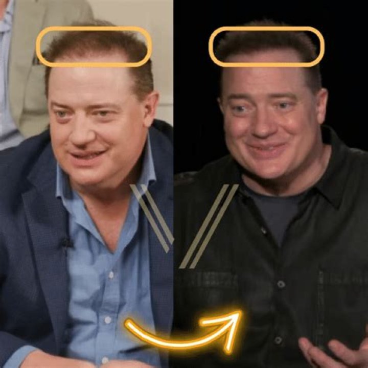 Brendan Fraser's Inspiring Weight Loss Journey