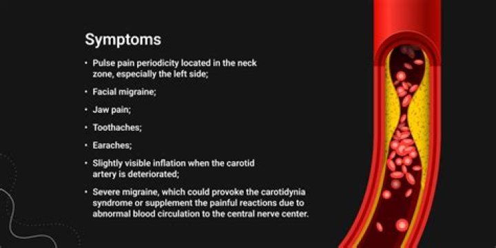 	CAROTIDYNIA IS A PAIN	