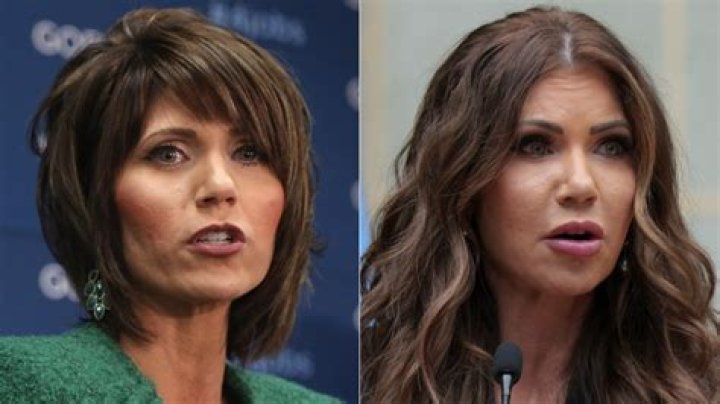 Did Kimberly Guilfoyle Have Plastic Surgery? An In-Depth Analysis