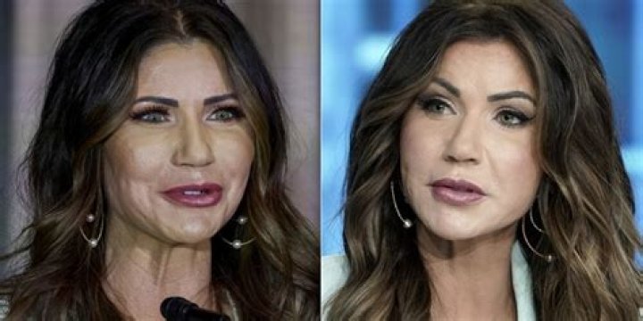 Did Kristi Noem Have Plastic Surgery? An In-Depth Analysis