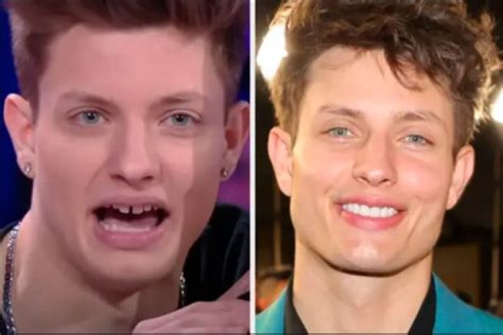 Discover The Secrets Of Matt Rife's Irresistible Smile