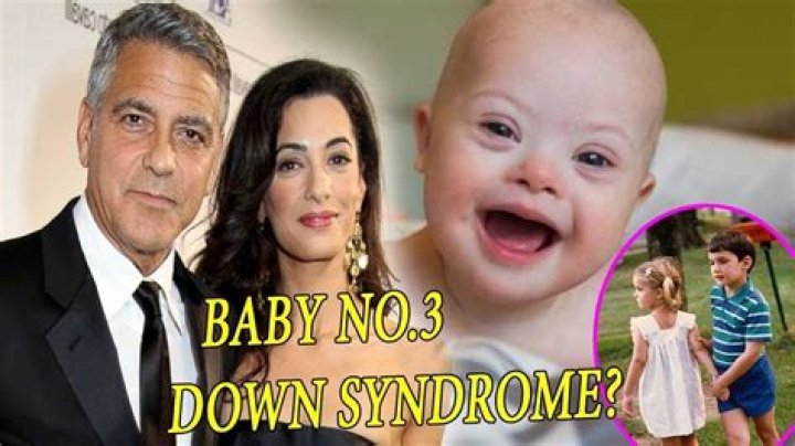 Does George Clooney's Child Have Down Syndrome? A Comprehensive Look