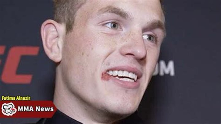 Does Ian Garry have herpes? Mouth scar triggers fan speculations during UFC 292 domination