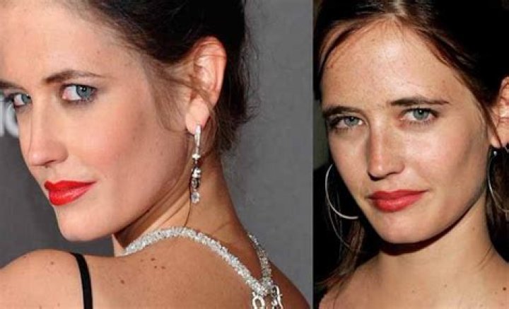 Eva Green Chirurgie