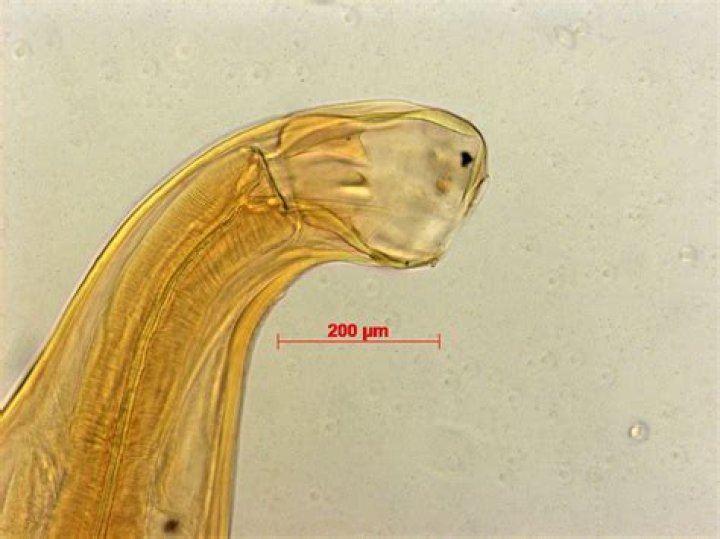 	Forget sharks; hookworms are lurking at the beach	