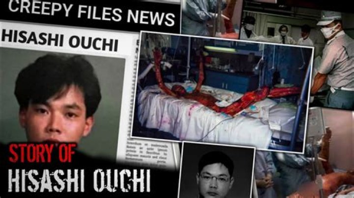 Hisashi Ouchi: The Tragic Story Behind Hisashi Ouchi Image