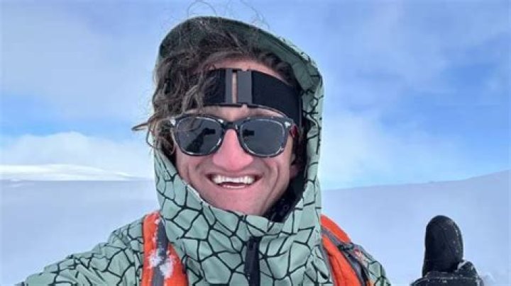 How Did Casey Neistat Fix His Teeth?