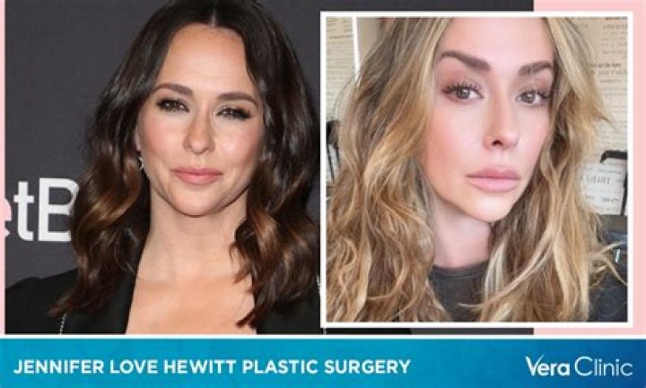 Jennifer Love Hewitt’s Plastic Surgery Claims Explained