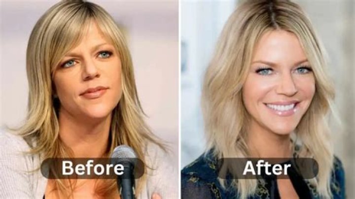 Kaitlin Olson Has Denied All Plastic Surgery Accusations