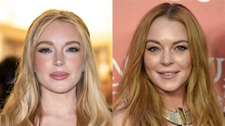 Lindsay Lohan's Plastic Surgery Journey: Unlocking The Truth And Beyond