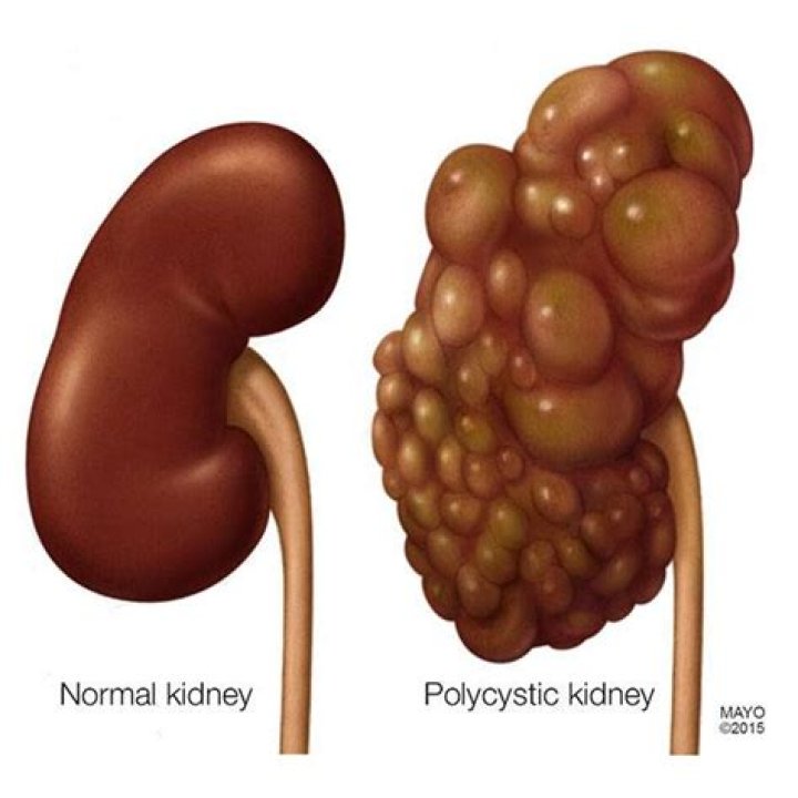 	Low platelet count not necessarily a reason to postpone surgery	