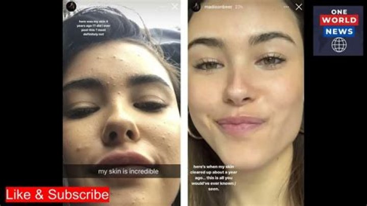 Madison Beer Leak Video: What You Need To Know