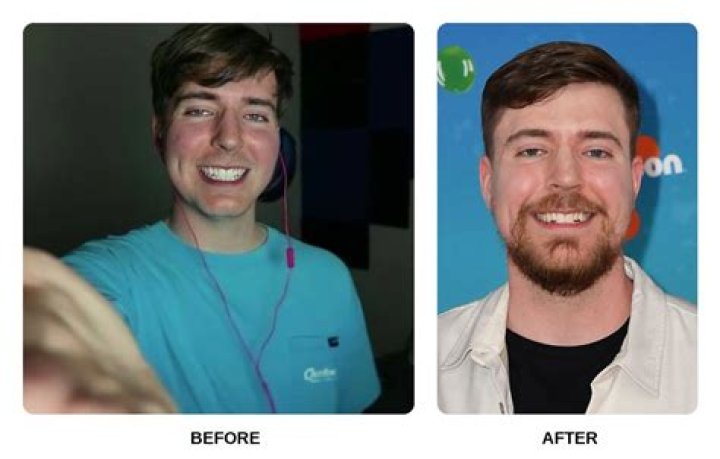 Matt Rife's Teeth Veneers: Unlocking The Secrets Of A Radiant Smile