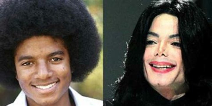 Michael Jackson Avant Chirurgie