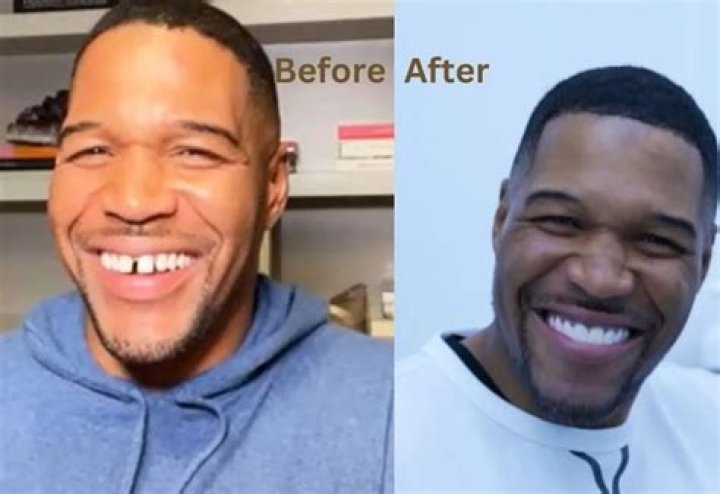 	Michael Strahan’s ‘fixed’ tooth gap was an April Fool’s Day prank	