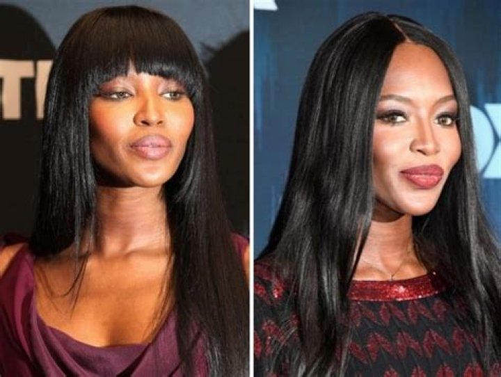 Naomi Campbell Plastic Surgery: The Evolution Of A Supermodel