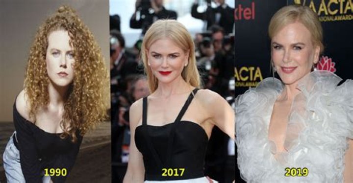 Nicole Kidman Chirurgie