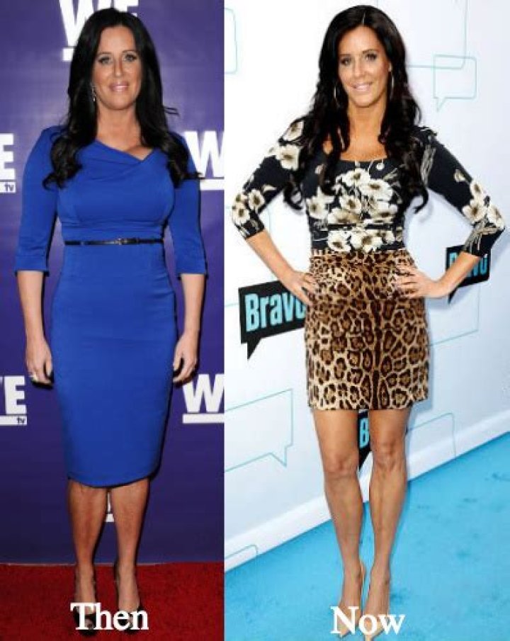 Patti Stanger Weight Loss & Diet: Health Condition After Plastic Surgery