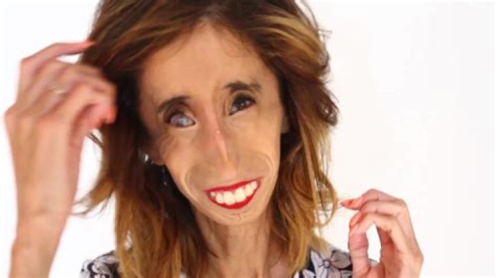 Pictures Of The Ugliest Woman In The World: A Deep Dive Into Beauty Standards And Perception