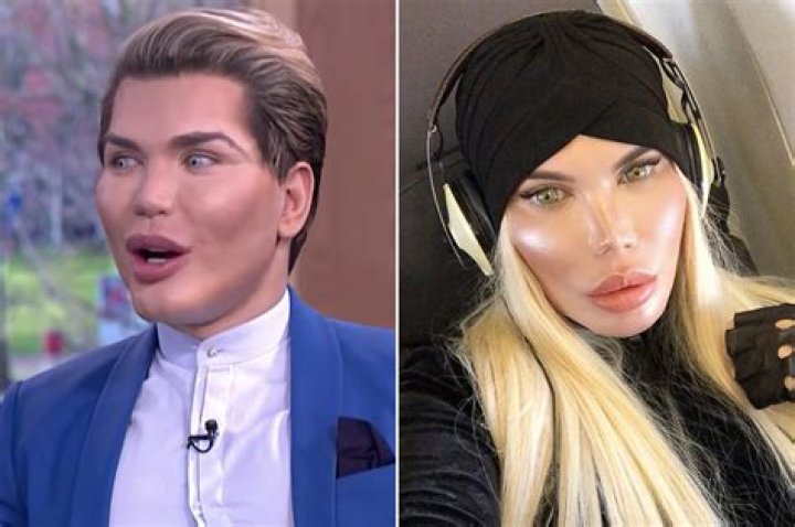 Plastic Surgery, Transgender & Instagram!