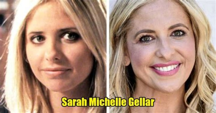 Sarah Michelle Gellar Chirurgie