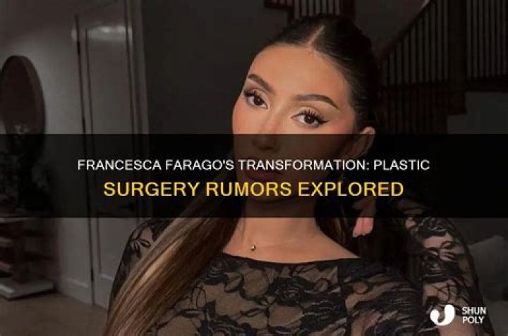 The Truth Behind Francesca Farago’s Plastic Surgery Rumors