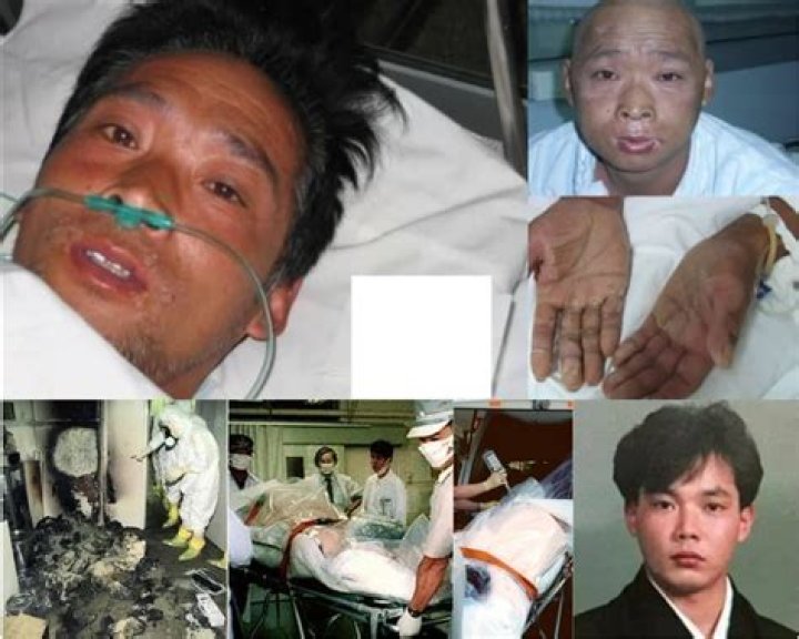 Understanding Hisashi Ouchi: The Tragic Story Of A Nuclear Accident Victim