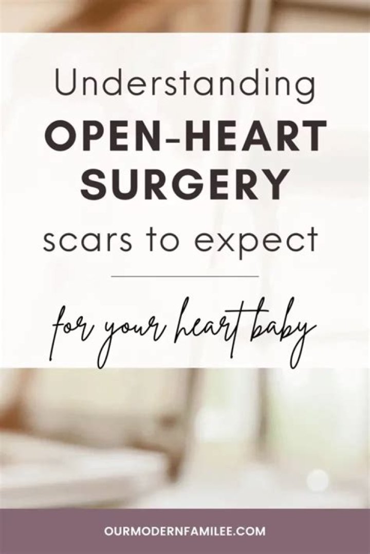 Understanding Open Heart Surgery Scars: Healing, Care, And Recovery