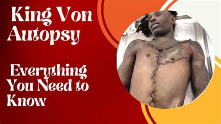 Understanding The Controversy Surrounding King Von's Autopsy Picture