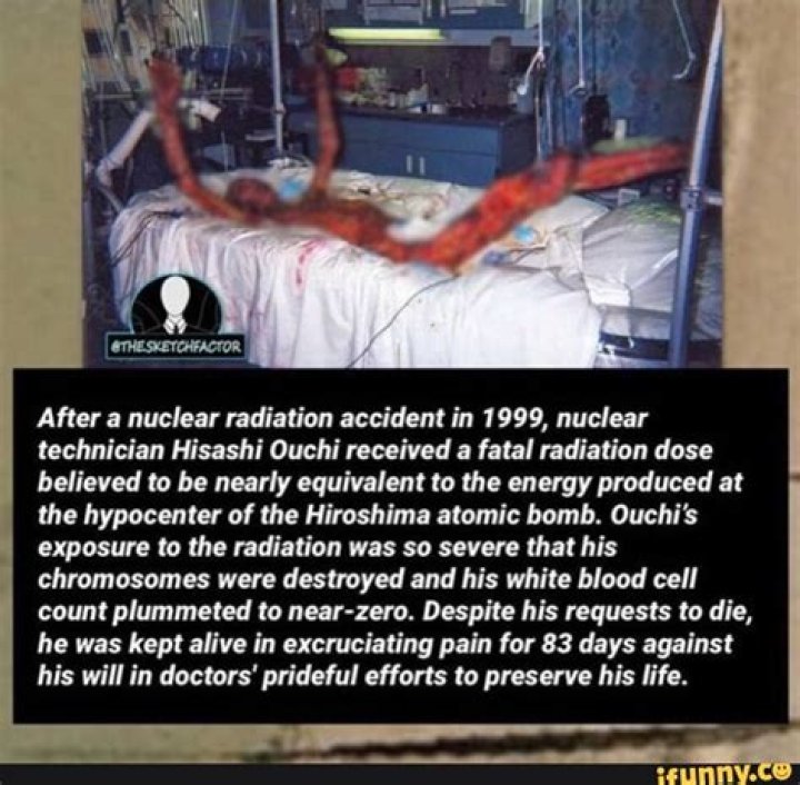 Unraveling The Hisashi Nuclear Accident: A Deep Dive Into A Controversial Incident