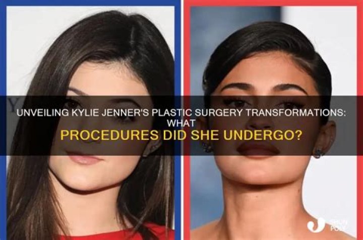 Unveiling Kylie Jenner's Weight: Secrets, Surprises, And Beyond