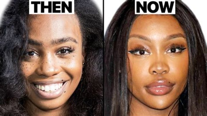 Unveiling Lisa's Transformation: Pre-Plastic Surgery Insights