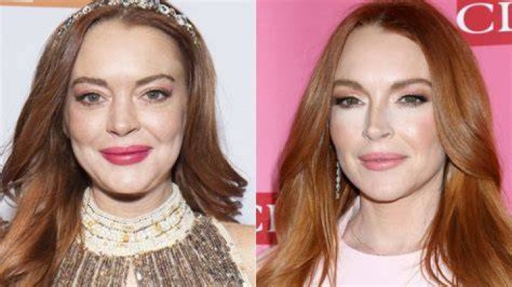 Unveiling The Truth Behind Lindsay Lohan's Cosmetic Surgery Journey