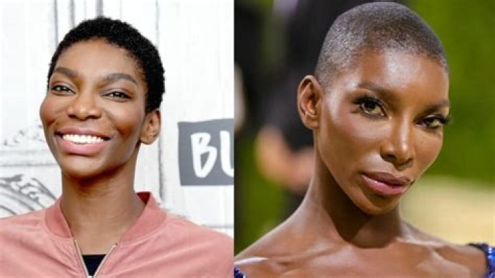 Unveiling The Truth Behind Michaela Cole's Plastic Surgery Journey