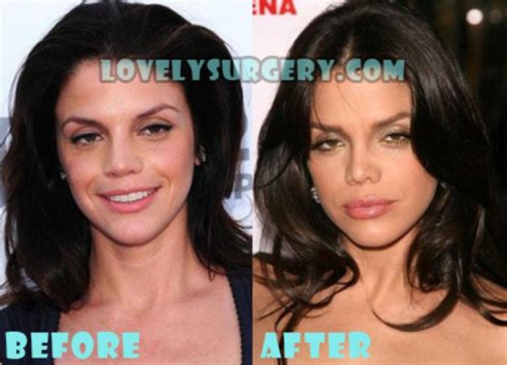 Unveiling Vanessa Ferlito's Plastic Surgery Journey: Discoveries And Insights