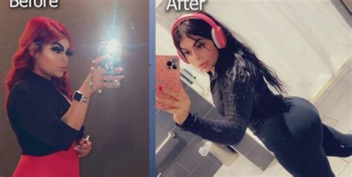 Woman nearly dies after getting plastic surgery in Mexico